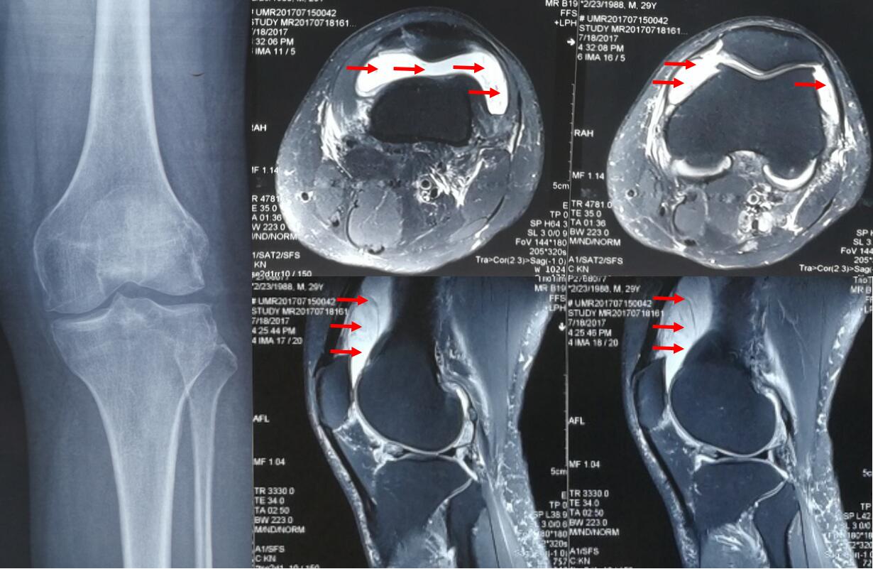 膝关节解剖素材-膝关节解剖图片-膝关节解剖素材图片下载-觅知网