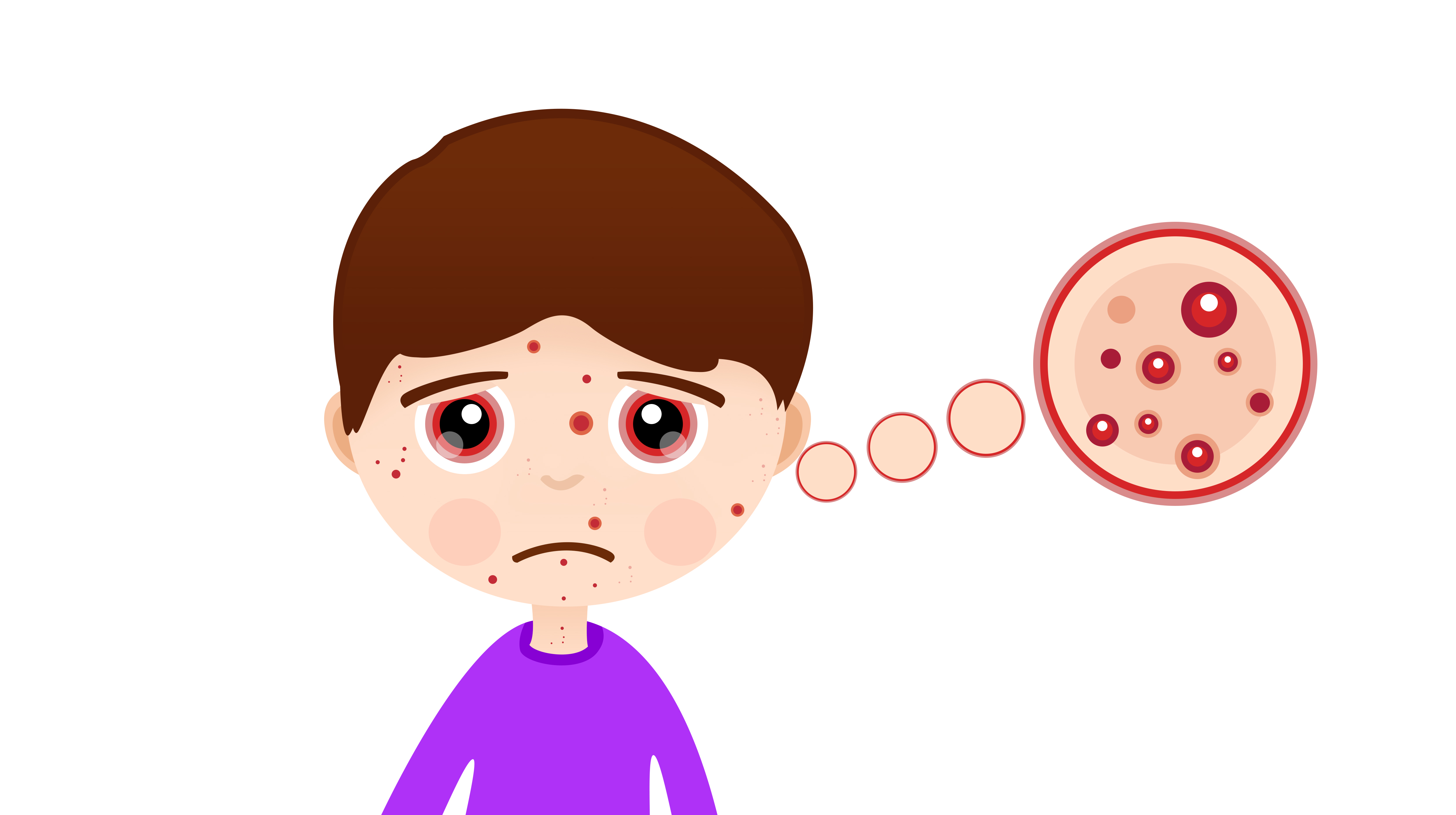 Acne Types Vector. Boy With Acne. Pimples, Wrinkles, Dry Skin ...